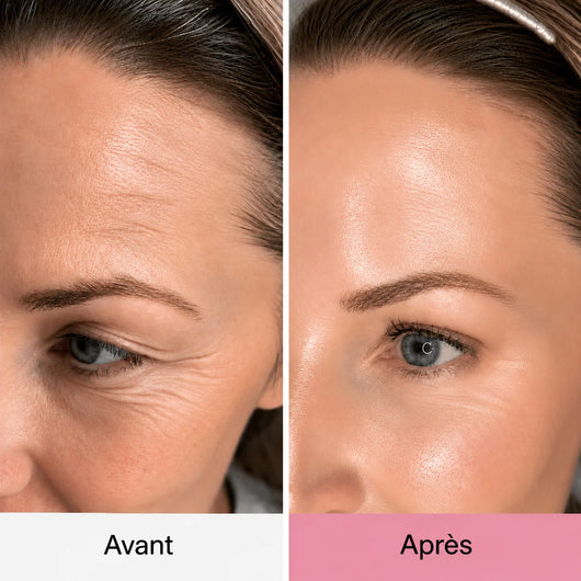 PureLift™ – Baume au PDRN et au collagène