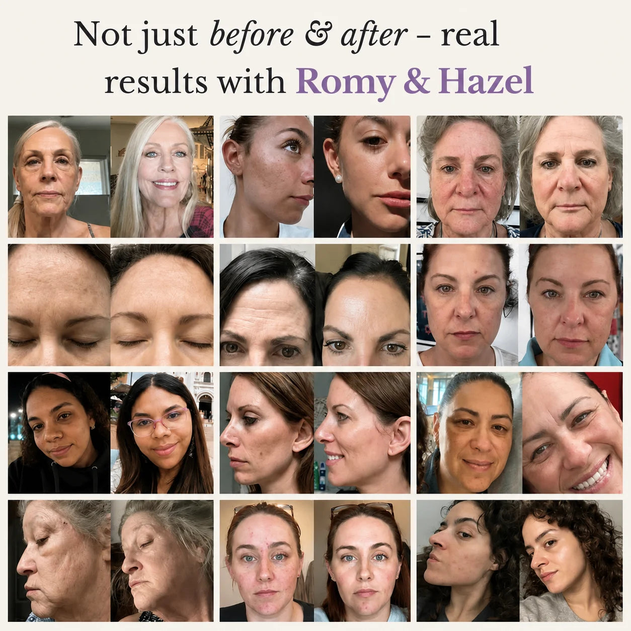 The Complete Romy & Hazel Skincare System for Mature Women